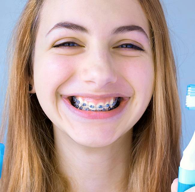 mujer con brackets de autoligado